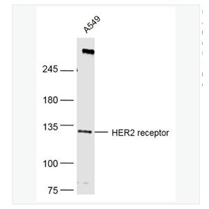 Anti-HER2 receptor  antibody-HER2受体单克隆抗体