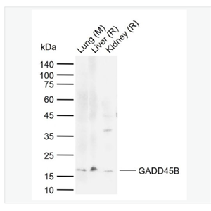 Anti-GADD45B antibody-生长抑制DNA损伤基因GADD45β抗体