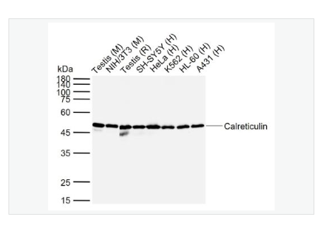 Anti-Calreticulin antibody-鈣網(wǎng)蛋白抗體 怎,Calreticulin