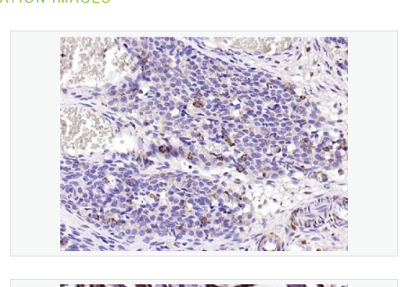 Anti-CD200 antibody-膜糖蛋白CD200抗体,CD200