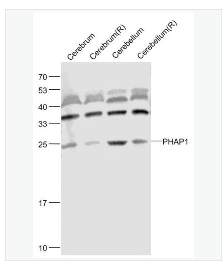 Anti-PHAP1 antibody-蛋白磷酸酶2A抑制劑1抗體,PHAP1