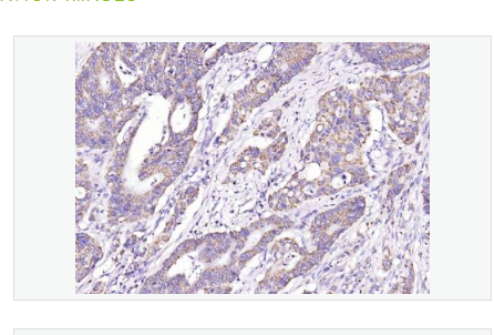 Anti-RASSF2 antibody-Ras相关结构域蛋白质2抗体,RASSF2