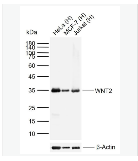 Anti-WNT2 antibody-信号通路Wnt2抗体,WNT2