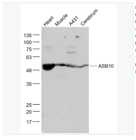 Anti-ASB10 antibody-含锚蛋白重复序列-细胞因子信号抑制物盒蛋白家族10抗体,ASB10