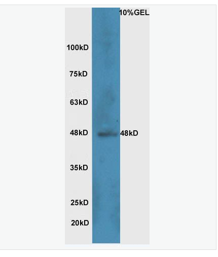 Anti-Wnt8b antibody-WNT蛋白家族Wnt8b抗体,Wnt8b
