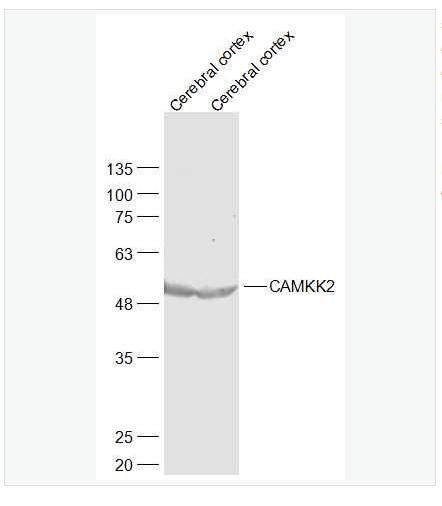 Anti-CAMKK2 antibody-钙调蛋白激酶激酶β抗体,CAMKK2