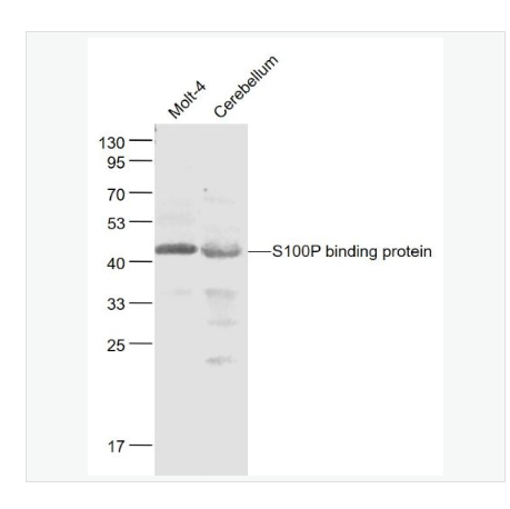 Anti-FCAR/CD89  antibody-免疫球蛋白A Fc段受体1抗体,FCAR/CD89