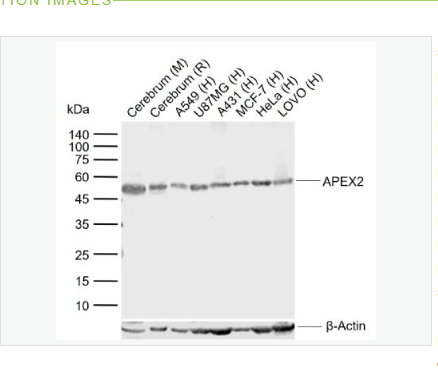 Anti-APEX2  antibody-嘌呤嘧啶核酸内切酶2抗体,APEX2