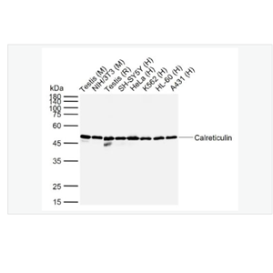 Anti-Calreticulin antibody-钙网蛋白抗体