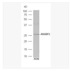 Anti-RASSF3 antibody-Ras相关区域家族1A抗体,RASSF3