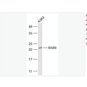 Anti-RAB9  antibody-ras癌基因家族Rab9蛋白抗体