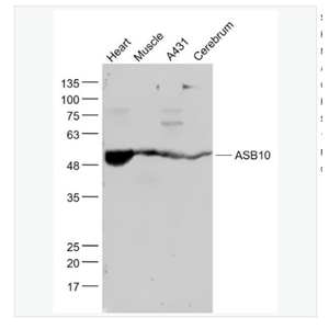 Anti-ASB10 antibody-含锚蛋白重复序列-细胞因子信号抑制物盒蛋白家族10抗体