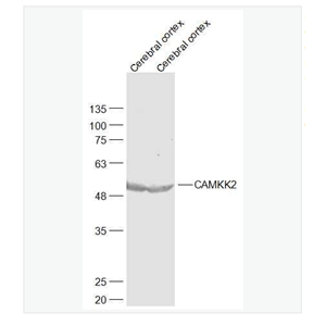 Anti-CAMKK2 antibody-钙调蛋白激酶激酶β抗体