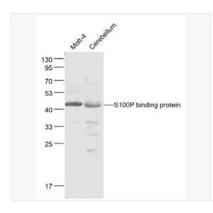 Anti-S100P binding protein  antibody-S100P结合蛋白抗体,SS100P binding protein