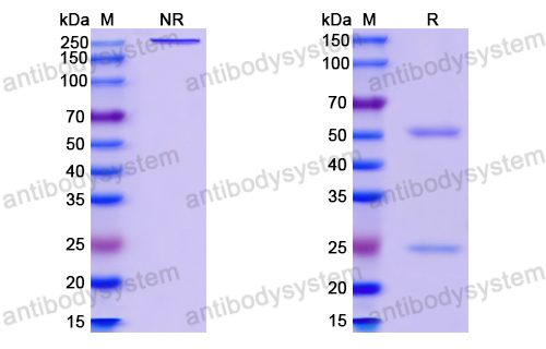 中和抗体-HBV-A S-HBsAg/SHB Antibody (Iv0151) VVV03701,S-HBsAg/SHB