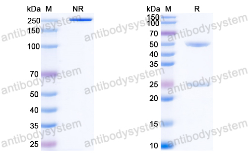 抗体：HBV-D HBeAg/C/p25 Antibody (E6#) RVV23601,HBeAg/C/p25