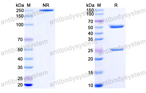 抗体：EBV/HHV-4 gL/BKRF2 Antibody (E1D1) RVV15401,gL/BKRF2