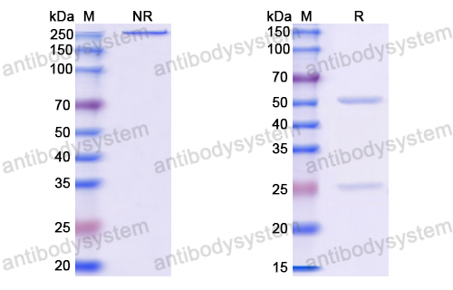 抗体：HBV-D HBcAg/C/p21.5 Antibody (E21#) RVV11502,HBcAg/C/p21.5