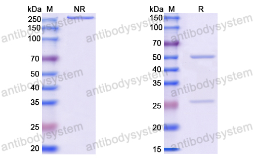 抗体：HBV-D HBcAg/HBeAg Antibody (E13#) RVV11501,HBcAg/HBeAg