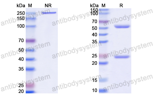 抗体：HCV p21/Mature core protein Antibody (19D9D6) RVV09301,p21/Mature core protein