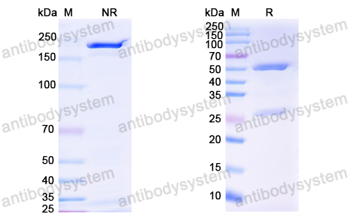 抗体：HCV gp32/gp35/Envelope glycoprotein E1 Antibody (IGH526) RVV08701,gp32/gp35/Envelope glycoprotein E1