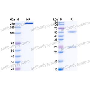 InVivoMAb Anti-HBV-A S/L-HBsAg/L glycoprotein Antibody (Iv0154)
