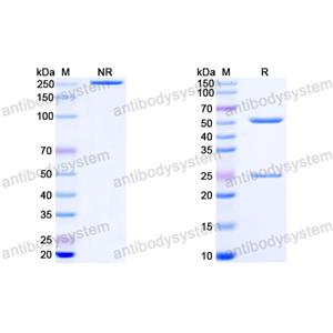 Anti-HIV-1 Capsid protein p24/CA protein Antibody (A3)