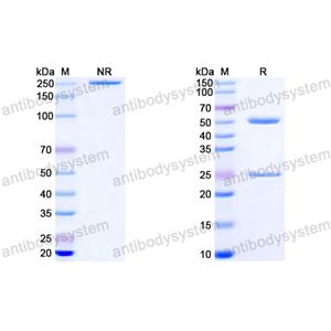Anti-HIV-1 Matrix protein p17/MA protein Antibody (M33)
