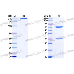 抗体：EBV/HHV-4 gL/BKRF2 Antibody (E1D1) RVV15401,gL/BKRF2