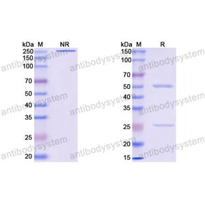 Anti-EBV/HHV-4 EBNA1/BKRF1 Antibody (16D2)