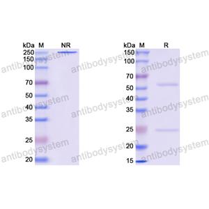 Anti-EBV/HHV-4 BLLF1/MA Antibody (72A1)