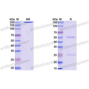 Anti-EBV/HHV-4 gH/gL Complexes Antibody (AMMO1)