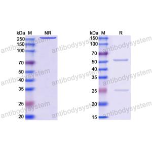 Anti-HEV Capsid protein Antibody (8G12)