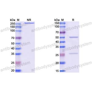 Anti-HBV-D HBcAg/HBeAg Antibody (E13#)