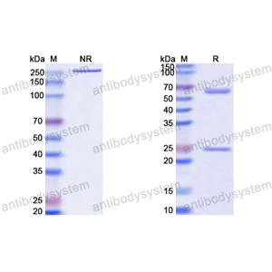 抗体：HCV ssRNA & Genome polyprotein Antibody (Fab HCV2) RVV09502,ssRNA & Genome polyprotein