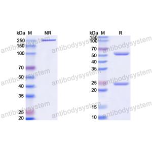 Anti-HCV p21/Mature core protein Antibody (19D9D6)