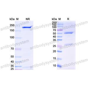 Anti-HCV gp32/gp35/Envelope glycoprotein E1 Antibody (IGH526)