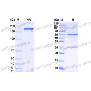 Anti-HCV NS1/gp68/gp70/Envelope glycoprotein E2 Antibody (22D11)
