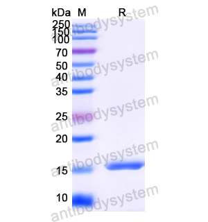 抗HIV-1 nef/F-protein protein Antibody (SAA1423) RVV23901,nef/F-protein/Negative factor