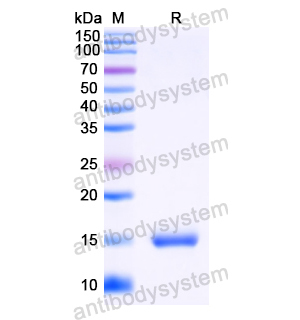 抗HIV-1 Vif/SOR protein Antibody (SAA1421) RVV23701,Vif/SOR protein