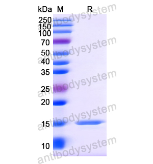 抗 Vesicular stomatitis Indiana virus/VSIV NP/Nucleoprotein (SAA1125)(RVV09905),Anti-Vesicular stomatitis Indiana virus/VSIV NP/Nucleoprotein Nanobody (SAA1125)