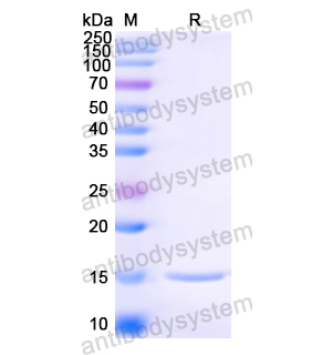 抗 Anti-HIV1 Surface protein gp120 Nanobody (SAA0894),Anti-HIV1 Surface protein gp120 Nanobody (SAA0894)