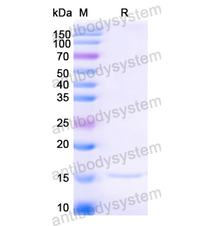 抗 Anti-HIV1 Surface protein gp120 Nanobody (SAA0881),Anti-HIV1 Surface protein gp120 Nanobody (SAA0881)