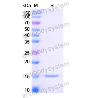 抗 Anti-HIV1 Surface protein gp120 Nanobody (SAA0912),Anti-HIV1 Surface protein gp120 Nanobody (SAA0912)