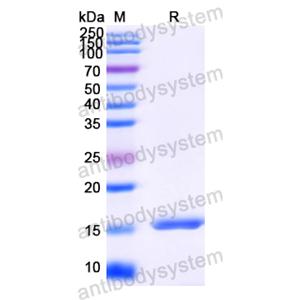 抗HIV-1 nef/F-protein protein Antibody (SAA1423) RVV23901,nef/F-protein/Negative factor