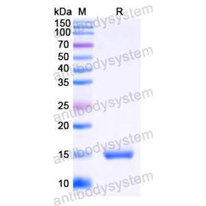 Anti-HIV-1 Vif/SOR protein Antibody (SAA1421)