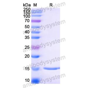 抗Anti-Human papillomavirus type 16 E6/Protein E6 Nanobody (SAA1338),Anti-Human papillomavirus type 16 E6/Protein E6 Nanobody (SAA1338)