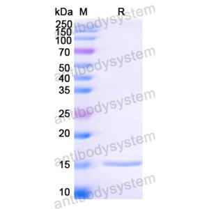 Anti-HIV1 Surface protein gp120 Nanobody (SAA0882)