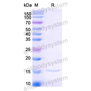 抗 Anti-HIV1 Surface protein gp120 Nanobody (SAA0881),Anti-HIV1 Surface protein gp120 Nanobody (SAA0881)