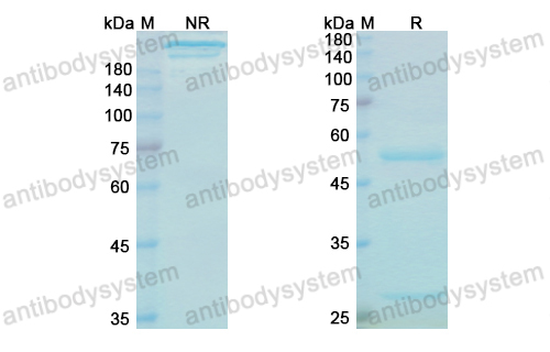 貝洛托舒單抗,Research Grade Bezlotoxumab  (DXX00301)